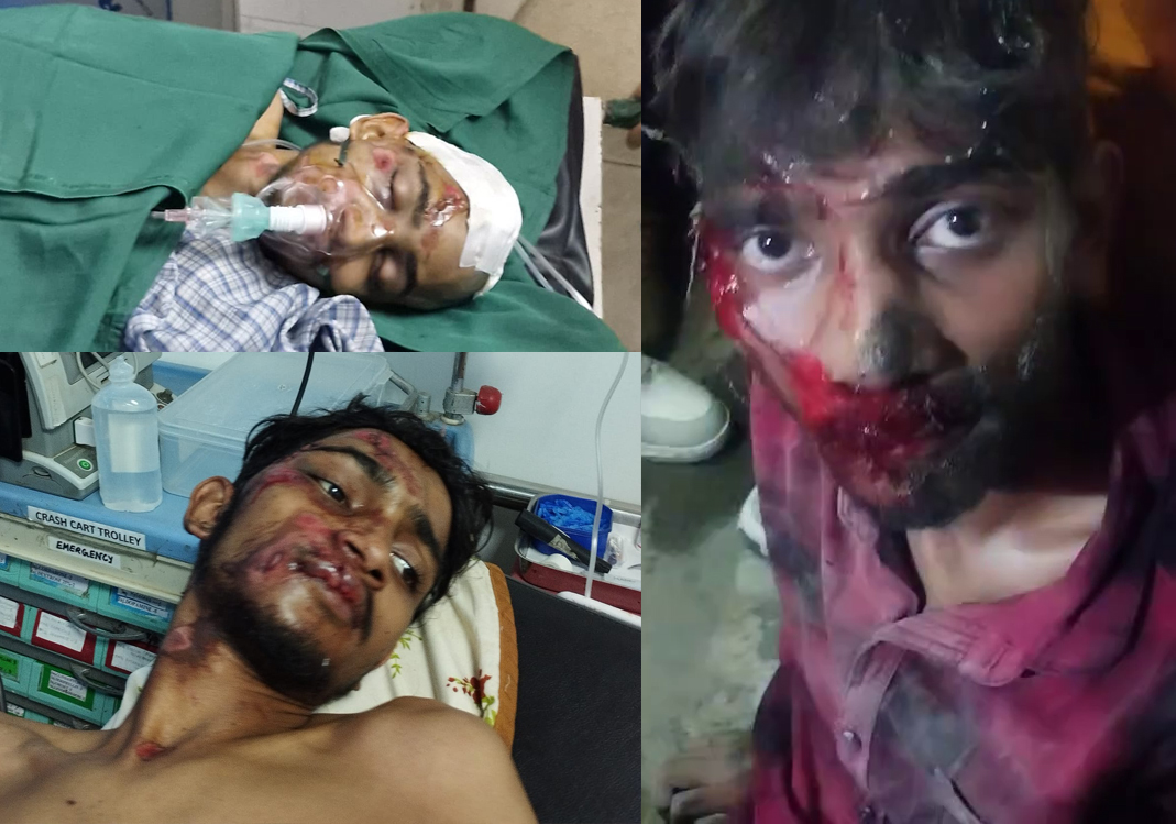 Lets donate for Debarshi to arrange a Kidney for him